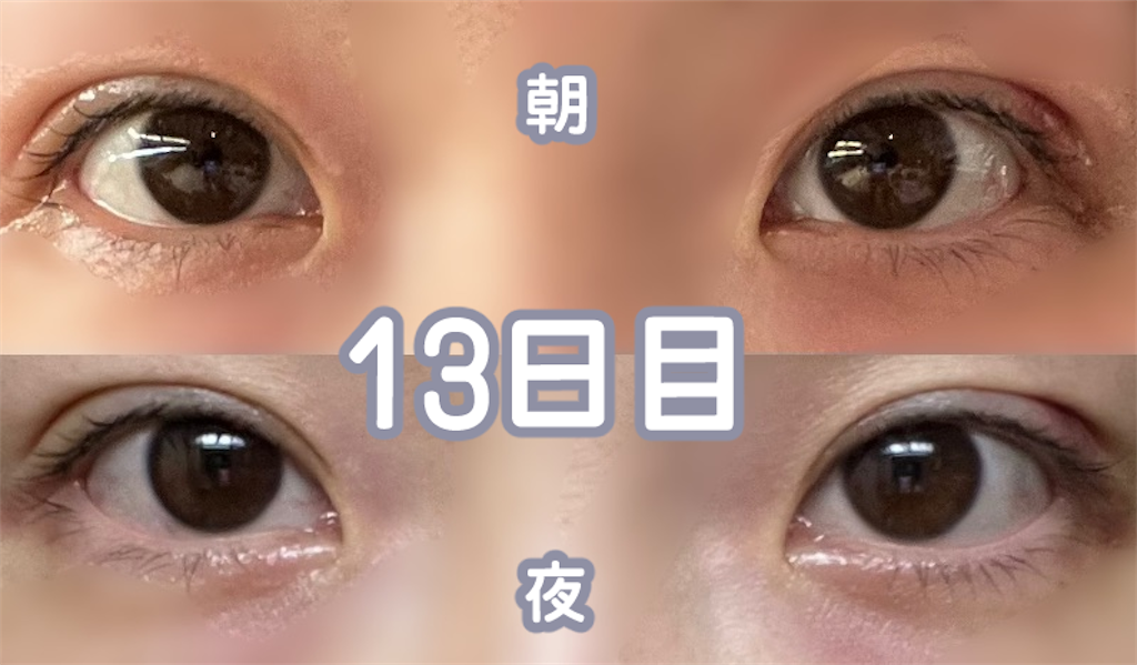f:id:henjanaimon:20250305231135p:image f:id:henjanaimon:20250305231135p:image