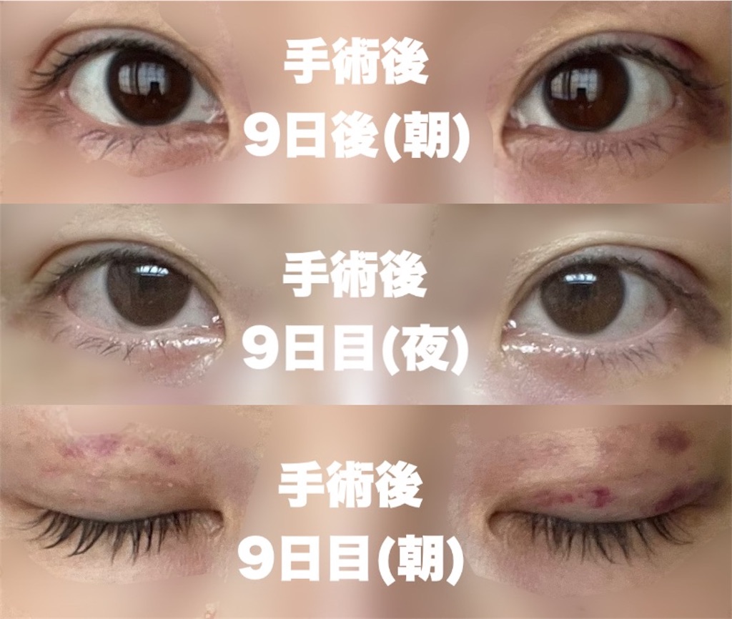 f:id:henjanaimon:20250305231142j:image f:id:henjanaimon:20250305231142j:image