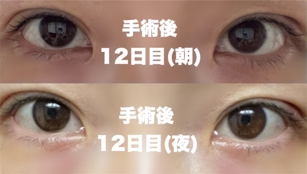f:id:henjanaimon:20250305231146j:image f:id:henjanaimon:20250305231146j:image