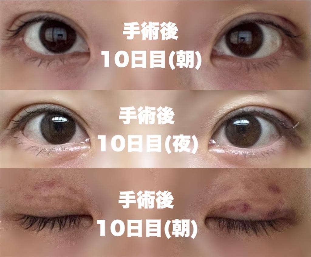 f:id:henjanaimon:20250305231149j:image f:id:henjanaimon:20250305231149j:image