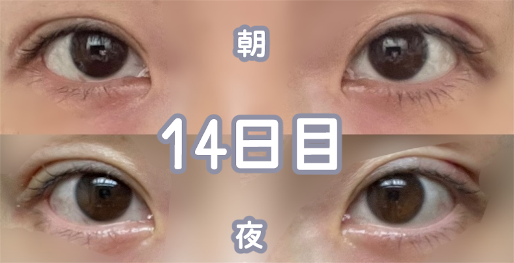 f:id:henjanaimon:20250305231454p:image f:id:henjanaimon:20250305231454p:image