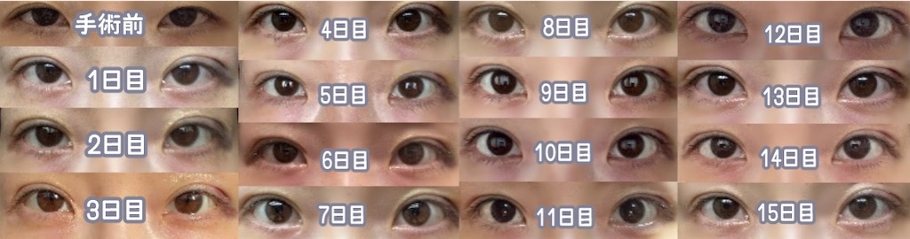 f:id:henjanaimon:20250305233144j:image f:id:henjanaimon:20250305233144j:image