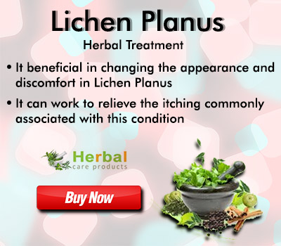 f:id:herbalcareproducts:20200629150551j:plain f:id:herbalcareproducts:20200629150551j:plain