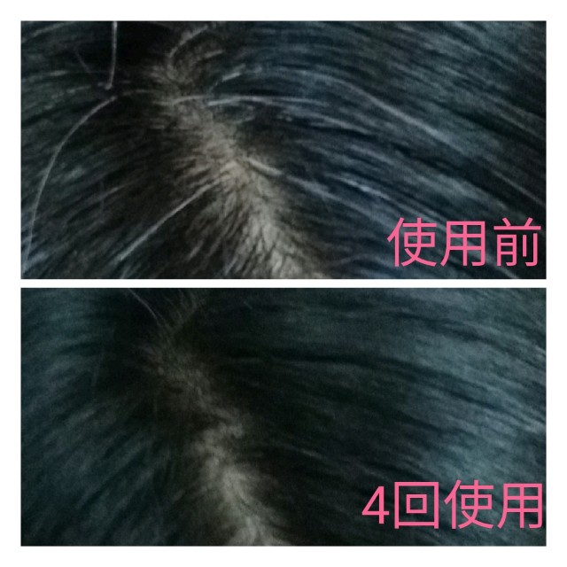 アラフォー白髪対策 花王 リライズ を使った感想 これは本当に次世代型白髪染め かもしれない 日々のなんとかしたいをなんとかするブログ