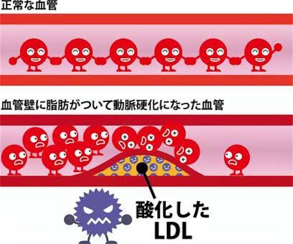 f:id:hidekiko:20210616110814j:image f:id:hidekiko:20210616110814j:image