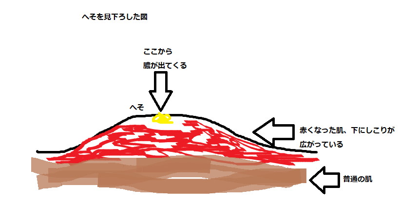 f:id:hideotakeshi:20200413232403p:plain