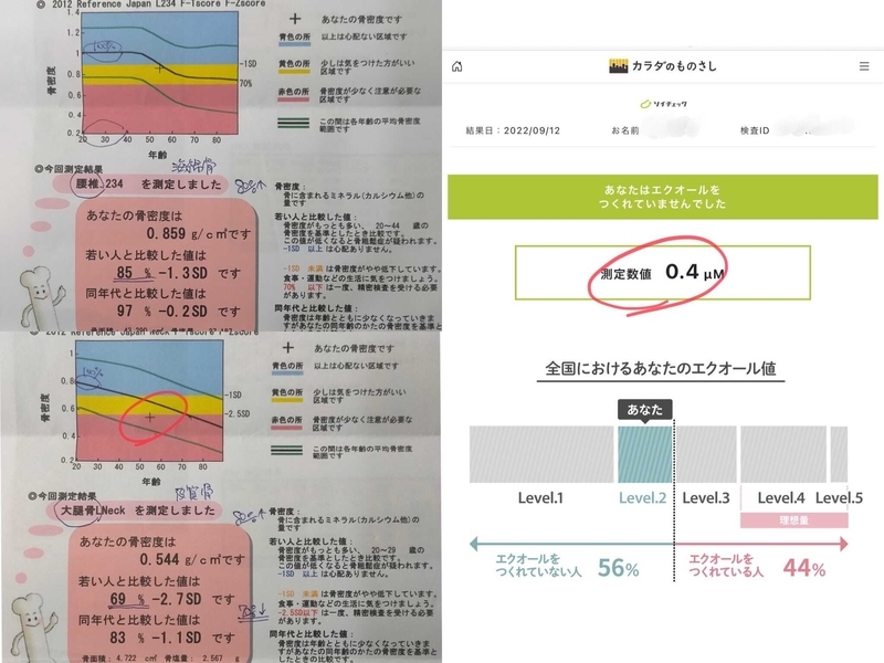 骨密度とエクオール検査