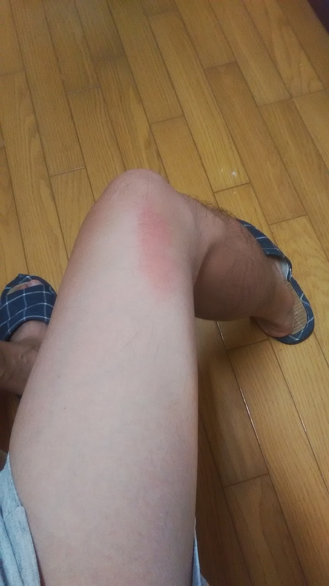 f:id:himitunokobeya:20210910165631j:plain