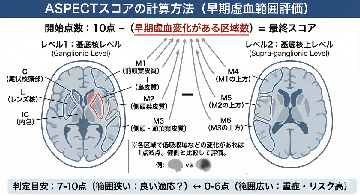 真空浄血療法　治療点解説 下肢静脈瘤とは（下肢静脈瘤血管内レーザー治療について） | 松本