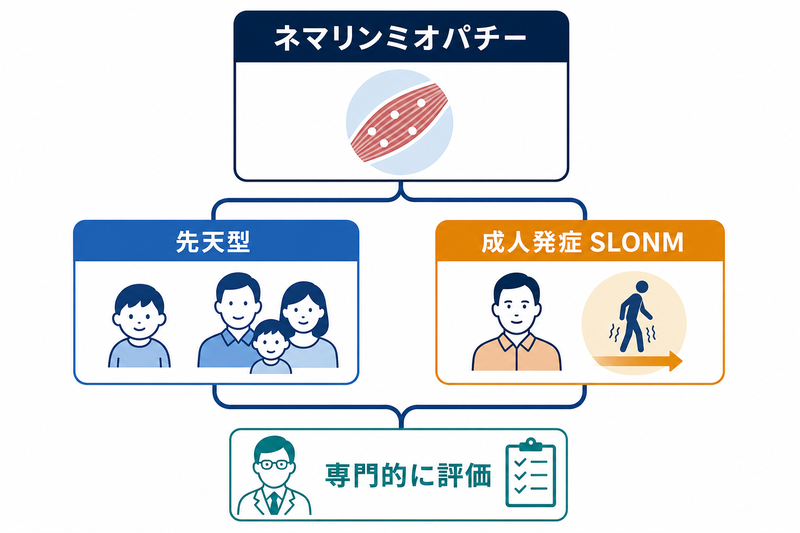 ネマリンミオパチーを先天型と成人発症SLONMに分け、発症時期と臨床経過をもとに整理する概念図