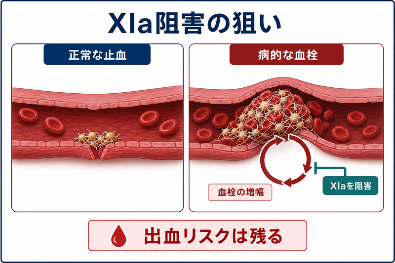 OCEANIC-STROKE試験の衝撃 ― XIa因子阻害薬asundexianが脳梗塞二次予防を変える - 医知創造ラボ ～脳神経内科医が ...