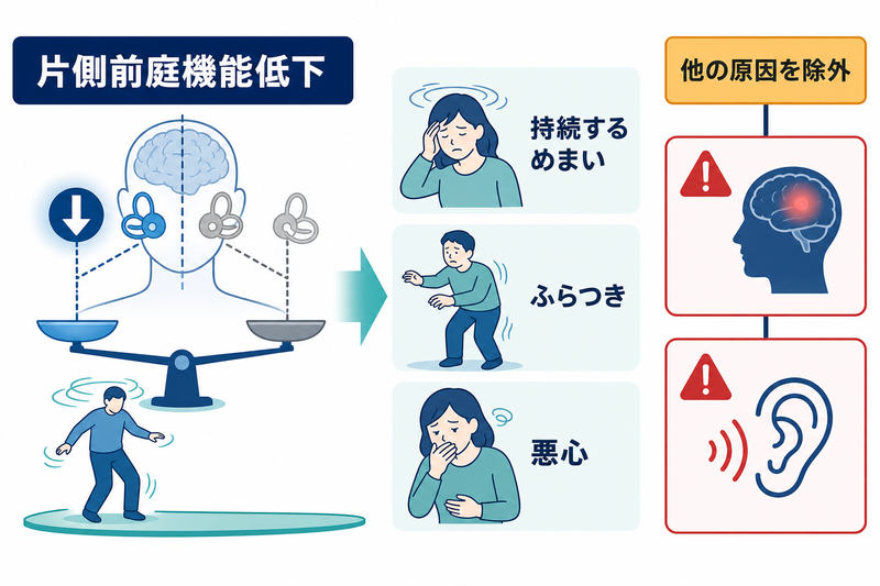片側前庭機能の急な低下で持続するめまい・ふらつき・悪心が起こり、急性の聴覚症状や中枢神経徴候を欠く概念図