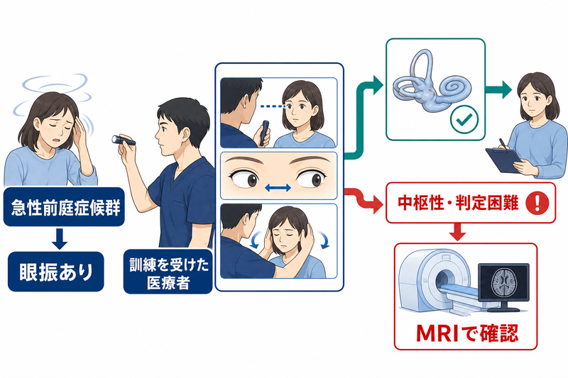 HINTSを急性前庭症候群で眼振がある患者に訓練を受けた医療者が用い、中枢性・判定困難ならMRIへ進む図