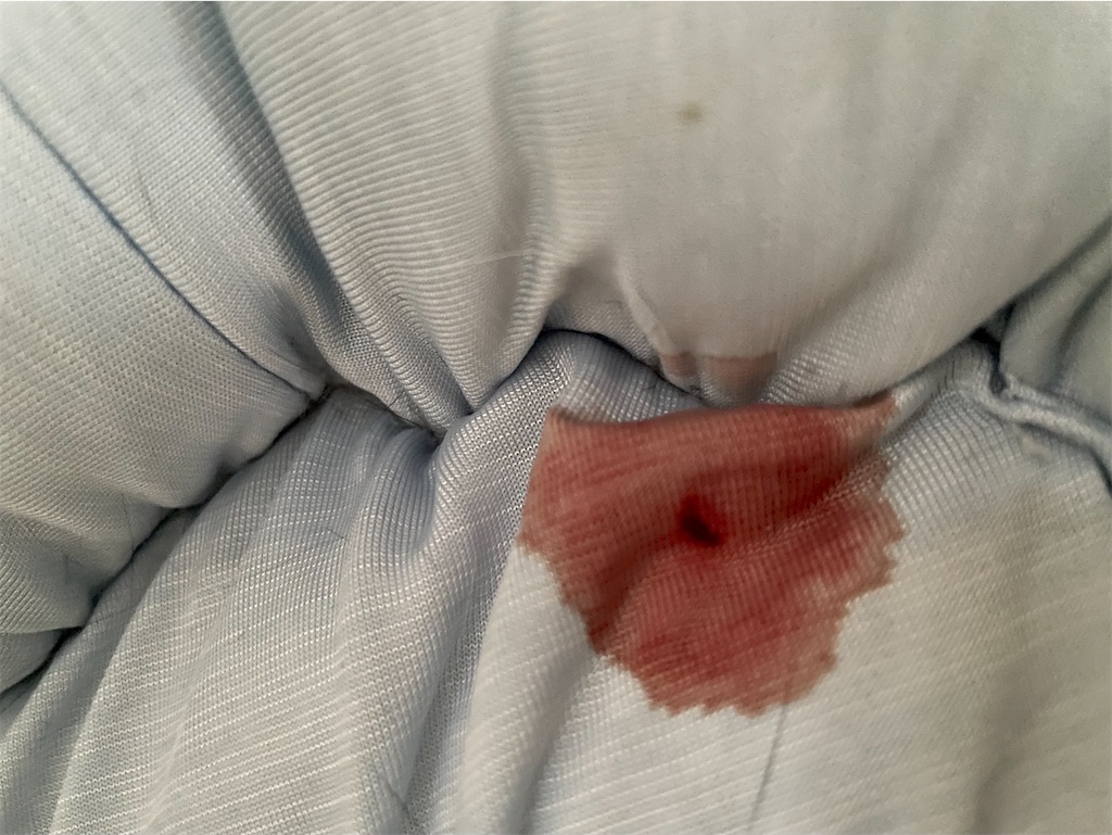 f:id:hiraryo0201:20210729173810j:image f:id:hiraryo0201:20210729173810j:image