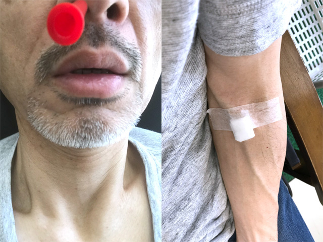 健康診断