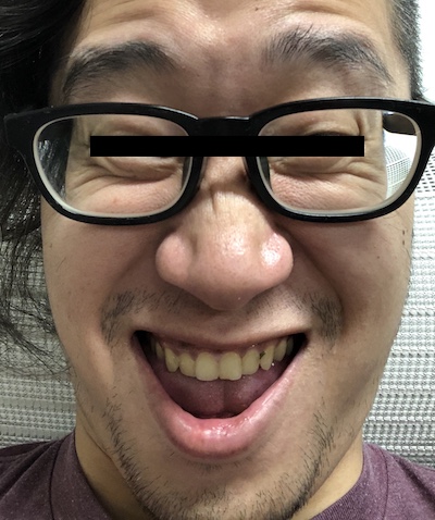 f:id:hiroqn:20181027230522j:plain