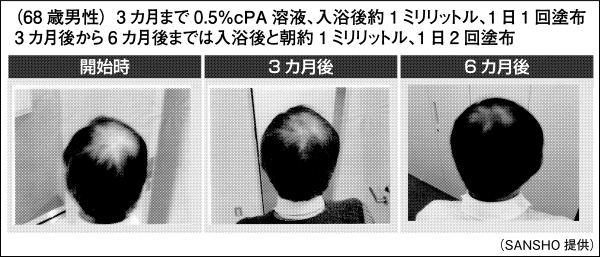 f:id:hitoritozan:20181226000327p:plain f:id:hitoritozan:20181226000327p:plain