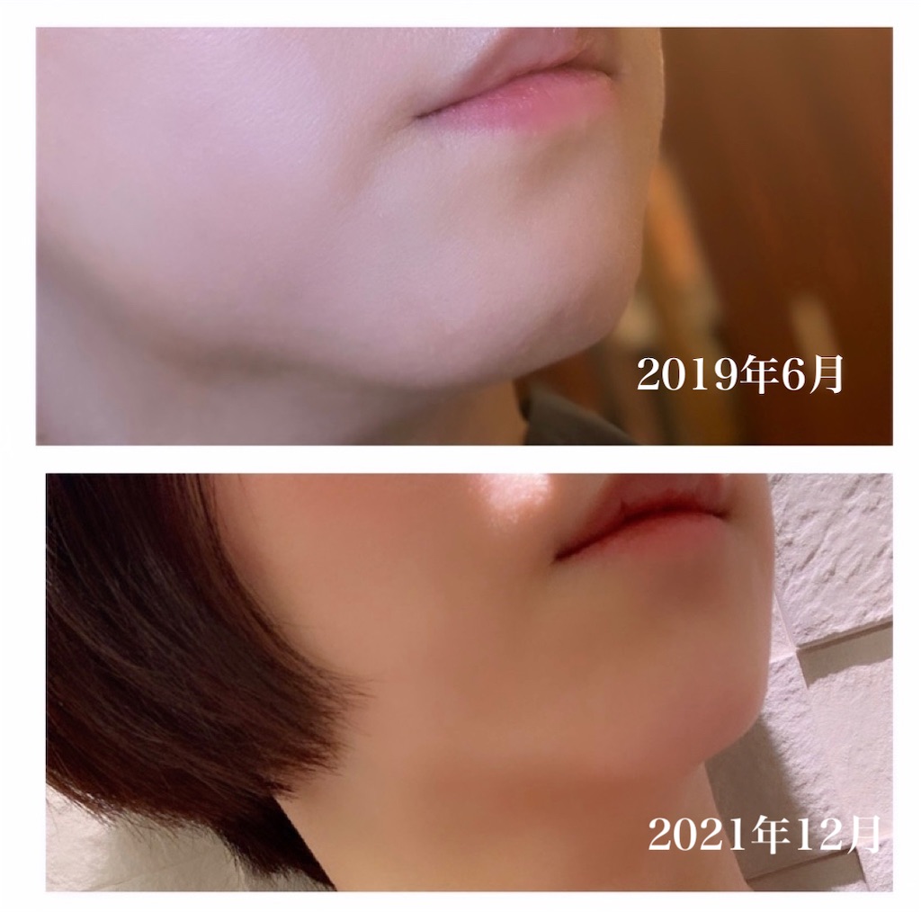 f:id:hitsucos:20220522192635j:image f:id:hitsucos:20220522192635j:image