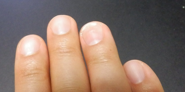 f:id:hmatsu47:20170210003501j:plain f:id:hmatsu47:20170210003501j:plain