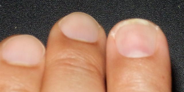 f:id:hmatsu47:20170217225629j:plain f:id:hmatsu47:20170217225629j:plain