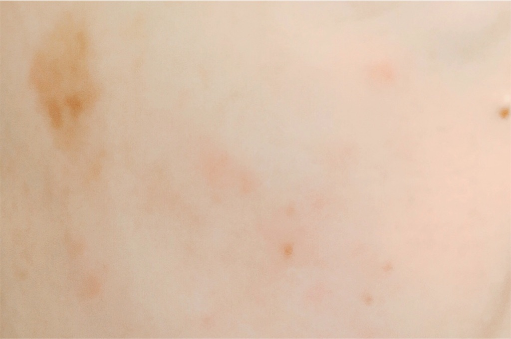 f:id:home-run:20181004095021j:image