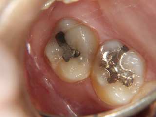 f:id:honey-dental:20200324231549j:plain