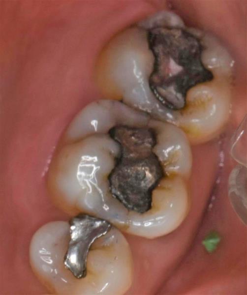 f:id:honey-dental:20200324231551j:plain