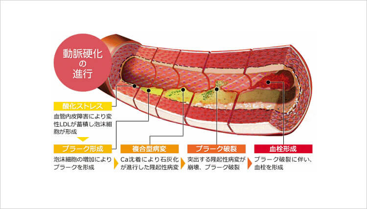 f:id:honey-dental:20201224202326j:plain