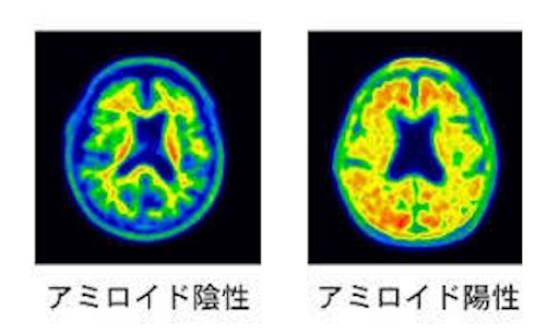 f:id:honeyhornet:20190929101528j:image f:id:honeyhornet:20190929101528j:image