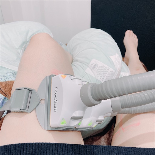 f:id:horitsukiko:20221210155731j:image