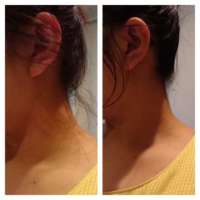 f:id:horumon_lady:20190626212034j:plain f:id:horumon_lady:20190626212034j:plain