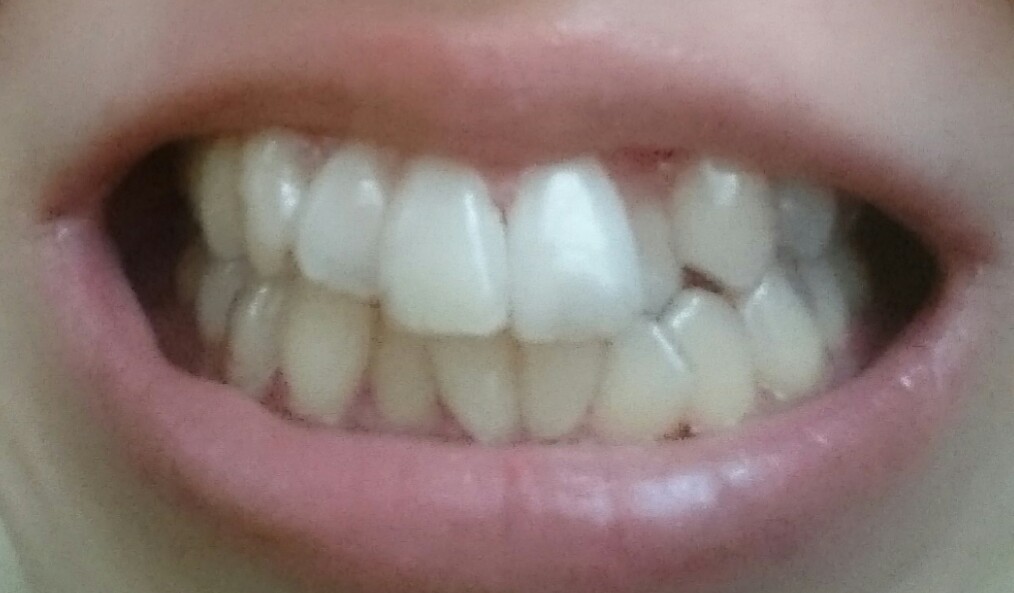 f:id:hotaimo:20210619235457j:plain
