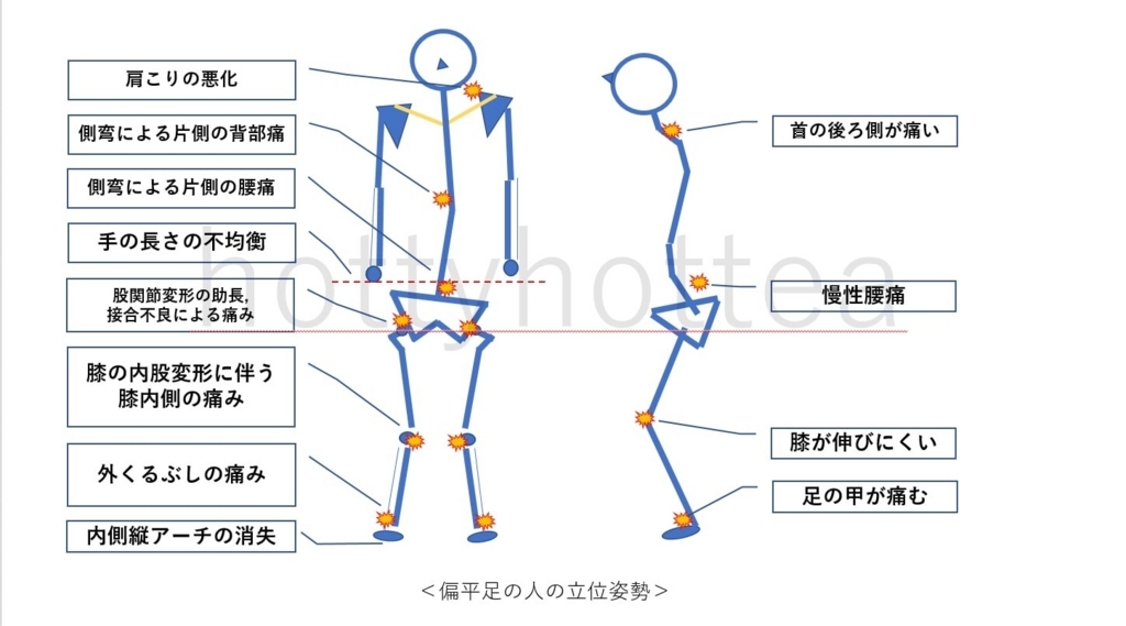 f:id:hottyhottea:20180529234639j:plain f:id:hottyhottea:20180529234639j:plain
