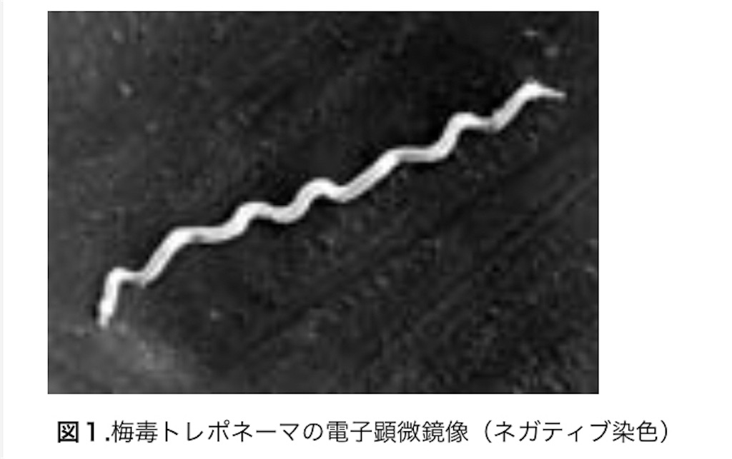 f:id:hougane99:20190803121513j:image