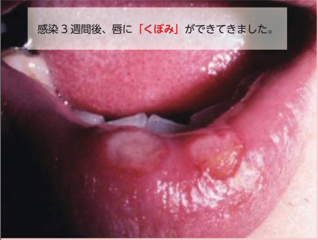 f:id:hougane99:20190803122428j:image