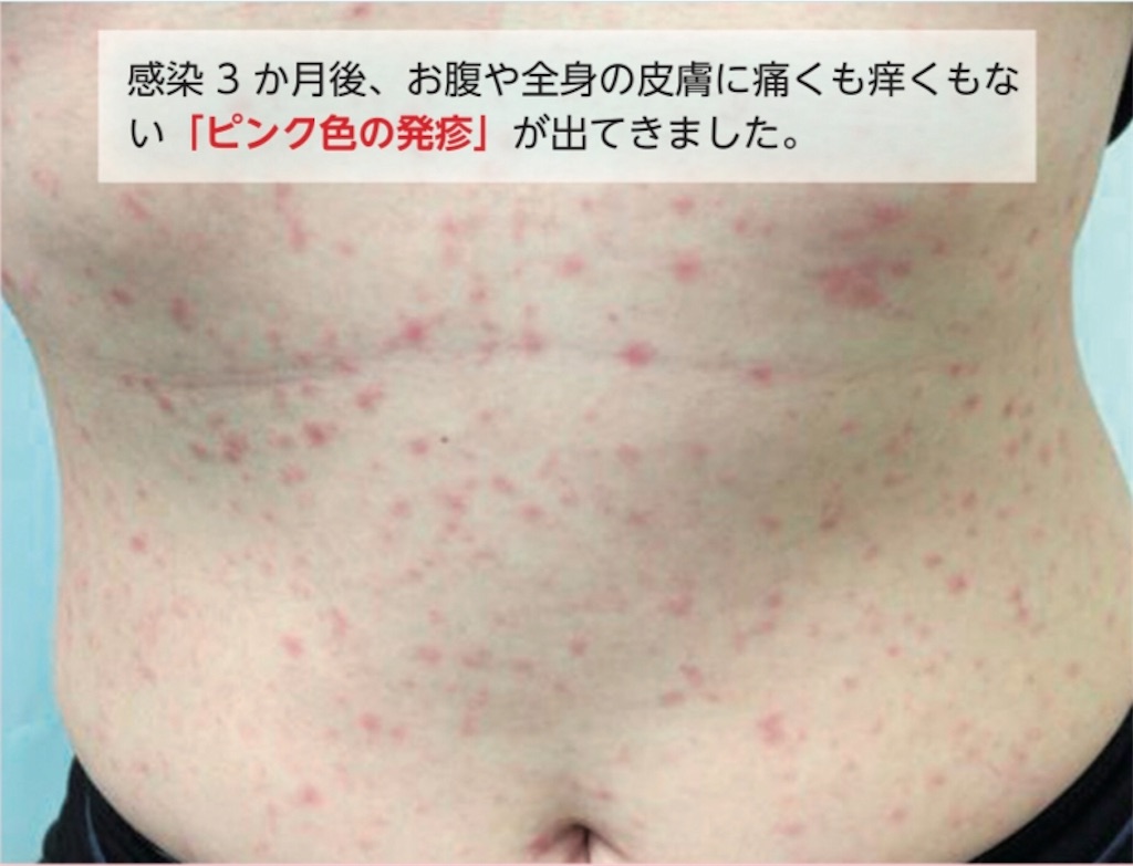 f:id:hougane99:20190803122439j:image