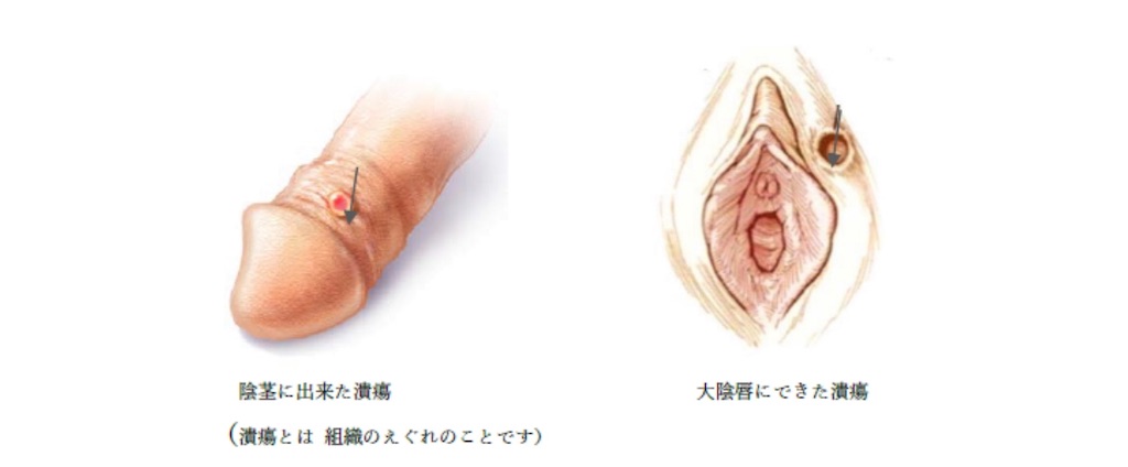 f:id:hougane99:20190803124333j:image