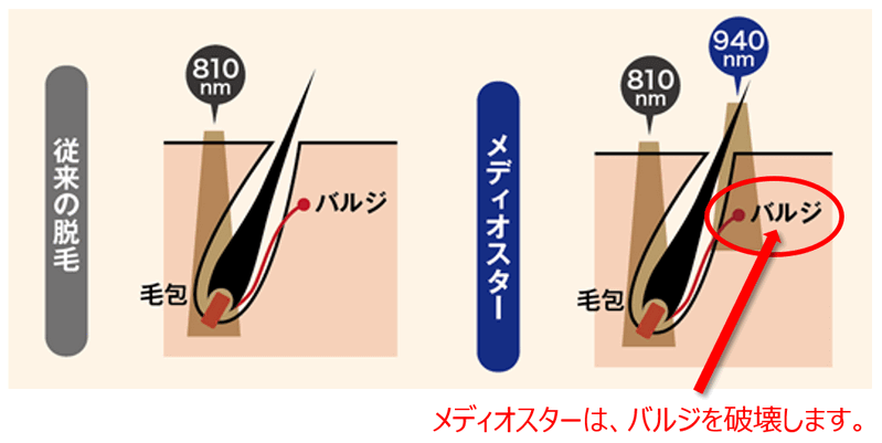 f:id:hourou_world:20170610020334p:plain f:id:hourou_world:20170610020334p:plain