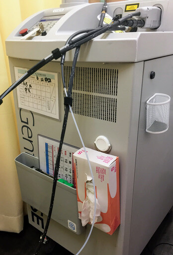 アレキサンドライトレーザー脱毛機の画像です。 アレキサンドライトレーザー脱毛機の画像です。