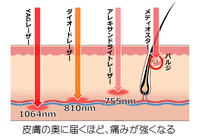 レーザーが届く範囲 レーザーが届く範囲