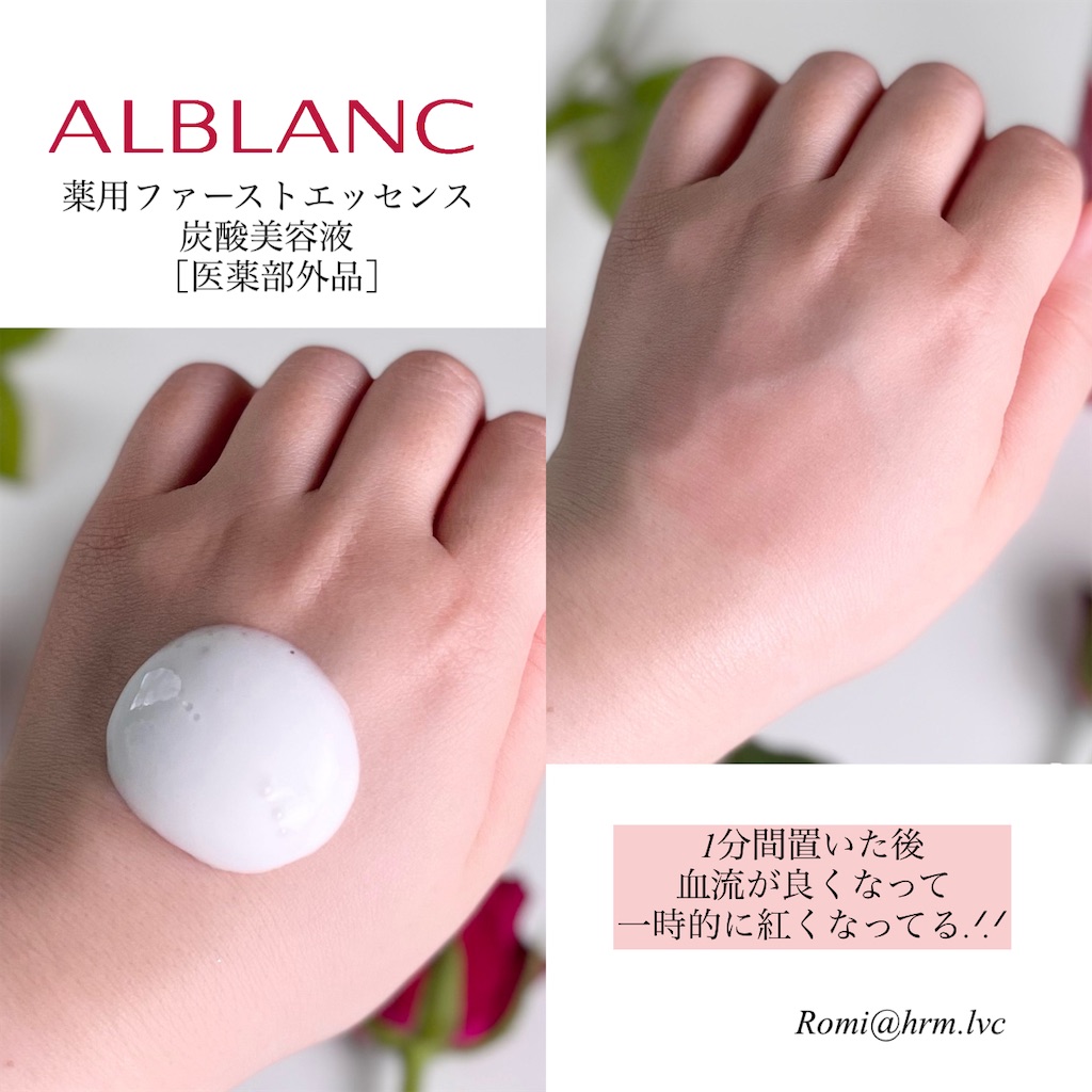 ALBLANC / 濃密マイクロ炭酸泡だからくすみに効く【アルブラン ALBLANC / 濃密マイクロ炭酸泡だからくすみに効く【アルブラン