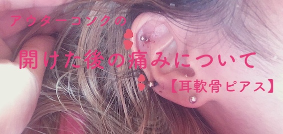 アウターコンクの開けた後の痛みについて詳しく書きました 耳軟骨ピアス ボディピアス シオンヌにっき