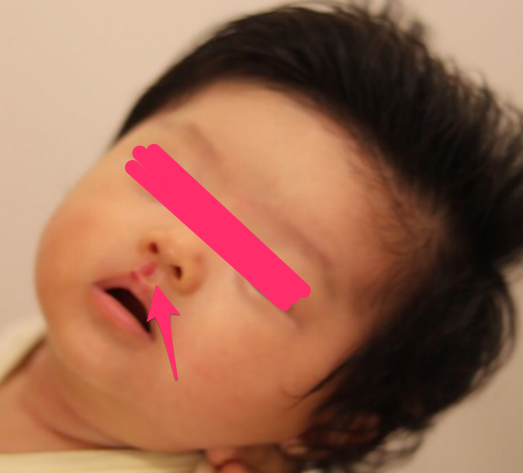 f:id:hsasak:20180314133843p:plain f:id:hsasak:20180314133843p:plain