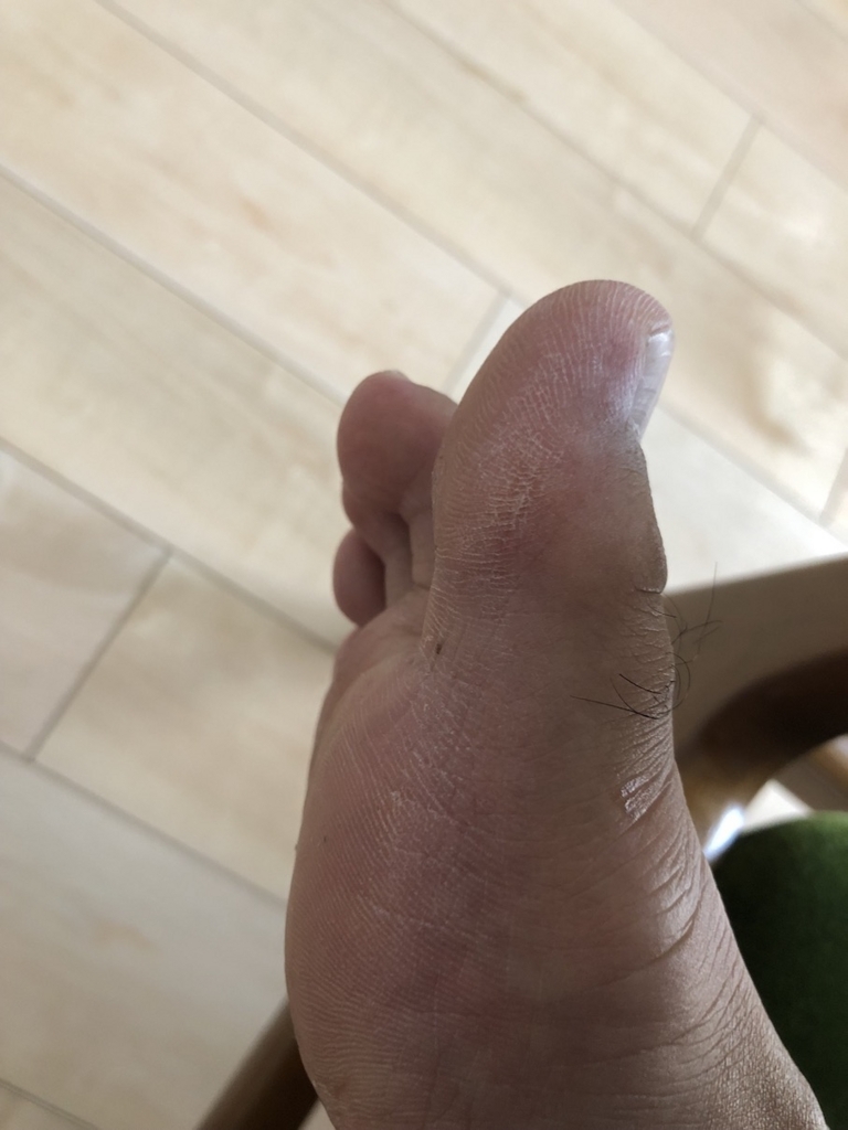 f:id:hsasak:20180705144500j:plain f:id:hsasak:20180705144500j:plain