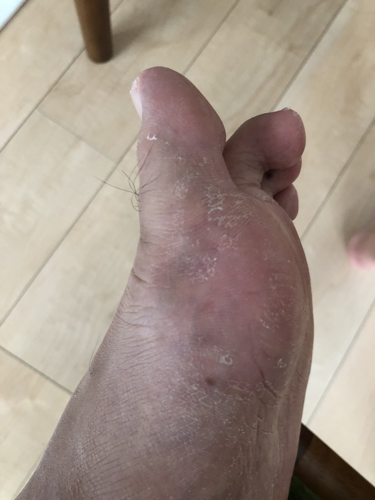 f:id:hsasak:20180705145931j:plain f:id:hsasak:20180705145931j:plain