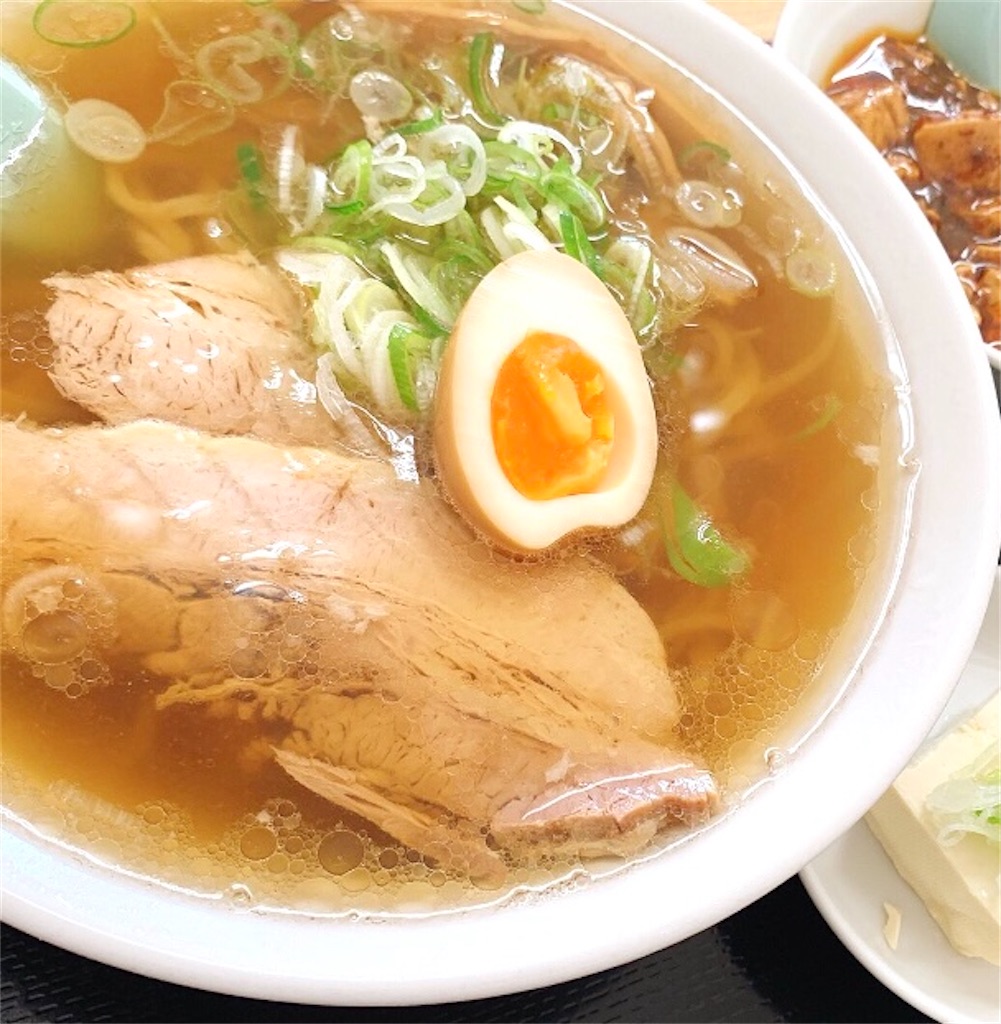 f:id:hukunekox:20211217204205j:image f:id:hukunekox:20211217204205j:image