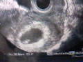 20101108182042