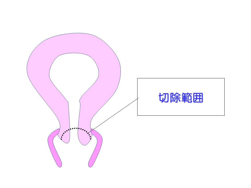 f:id:hutawa-ohana:20181229095047j:plain f:id:hutawa-ohana:20181229095047j:plain