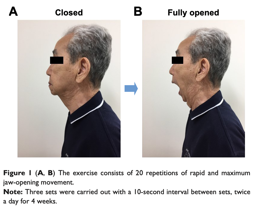 舌骨上筋の速筋線維のトレーニングにおける高速開口運動 - huuchiの音楽論文案内