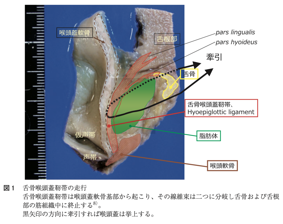 成人喉頭軟弱症 - huuchiの音楽論文案内